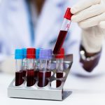 Un innovador análisis de sangre podría detectar la fibromialgia