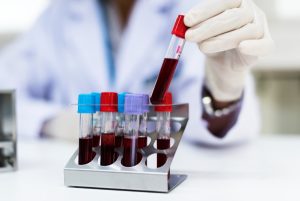 Un innovador análisis de sangre podría detectar la fibromialgia